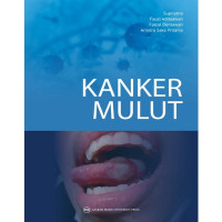 Image of Kanker Mulut